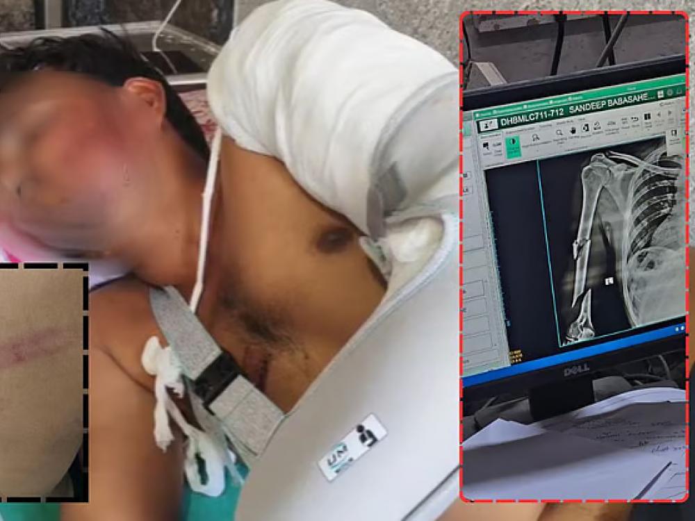 लोखंडी रॉडने तरुणाला अमानुष मारहाण..