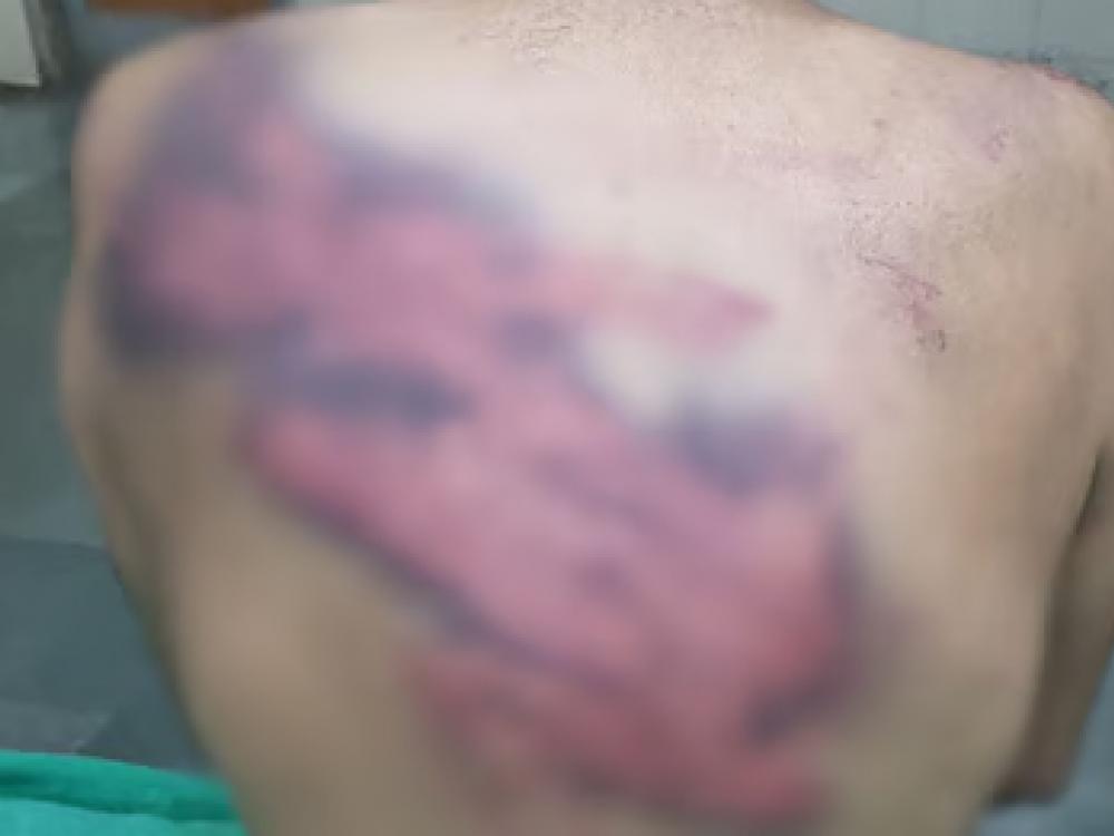 पैश्याच्या वादातून महिला महाविद्यालयाच्या कर्मचाऱ्यास मारहाण